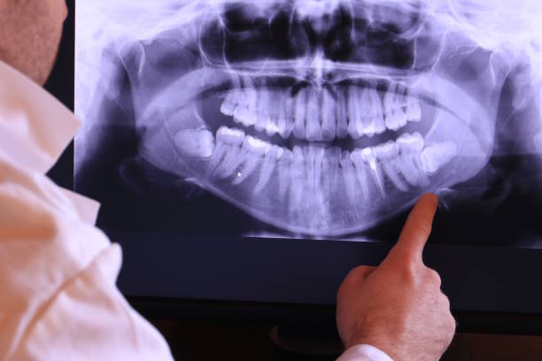 Best Emergency Broken Tooth Repair in Elk Point, SD